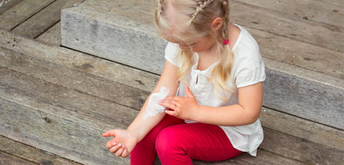 chickenpox